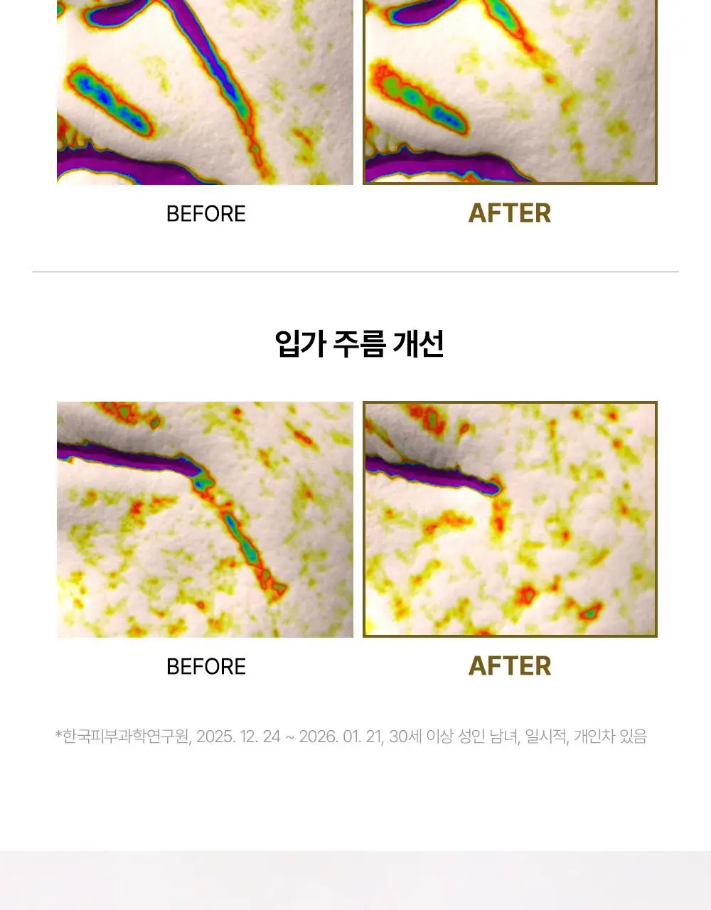 [30ml+30ml / 집중탄력케어] 아렌시아 레틴알 부스터 샷 30ml 더블기획 상세페이지 10